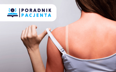 Poradnik Pacjenta: Słońce, a nasza skóra. Jak uniknąć oparzeń słonecznych?